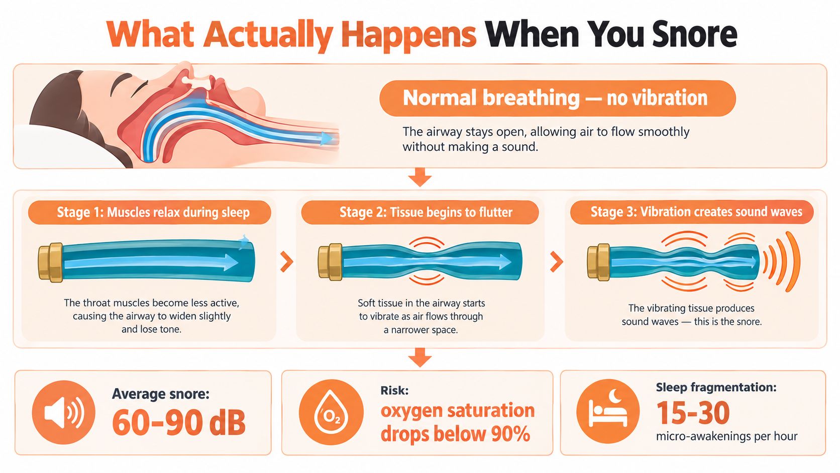An infographic illustrating the three stages of snoring, showing how relaxed throat muscles cause airway vibration.